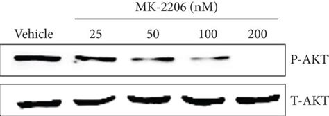 Andr Regulates Pi K Akt Enos Signalling In Vitro A The Expression Of