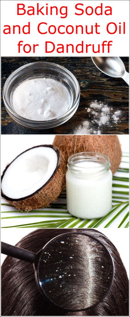 Baking Soda And Coconut Oil For Dandruff Baking Soda Uses And Diy