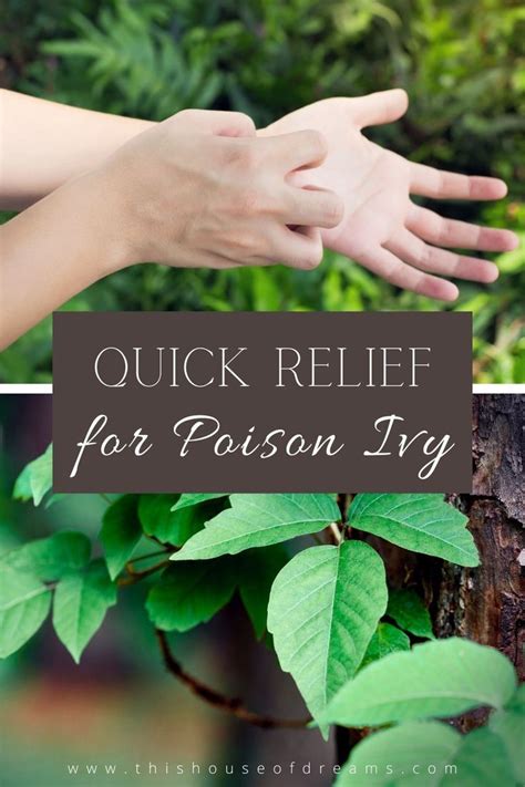 How To Get Natural Relief For Severe Poison Ivy Poison Ivy Remedies