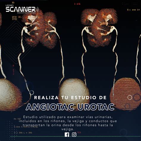 Tomografía Computada Lázaro Scanner Diagnóstico Por Imagen