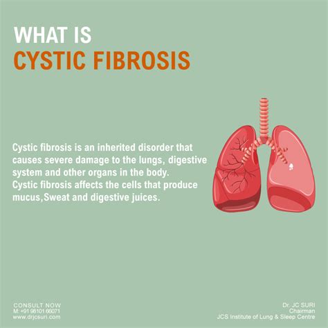 Cystic Fibrosis Cf Symptoms Causes Diagnosis And Treatment