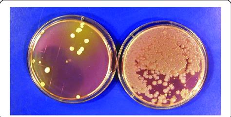 Contact Agar Plate Cultures Showing Bacterial Colonies Recovered From A Download Scientific