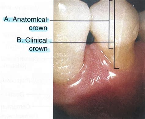 Dental Assisting Oral Embryology And Histology Flashcards Quizlet