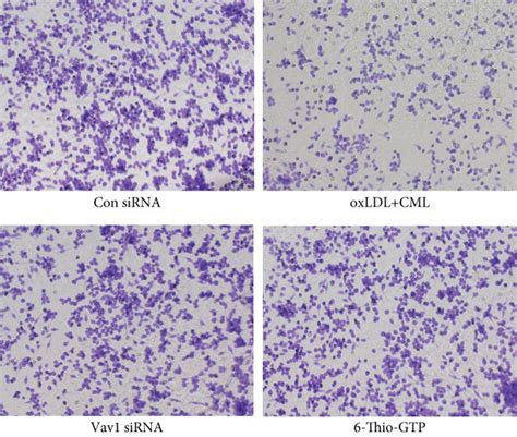 Cml Inhibit Lamellipodia Formation And Foam Cell Migration In Vivo And