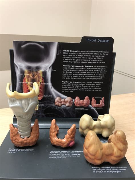 Thyroid Cartilage Anatomy Model