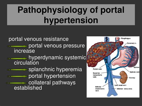 Ppt Portal Hypertension Powerpoint Presentation Free Download Id 7069626