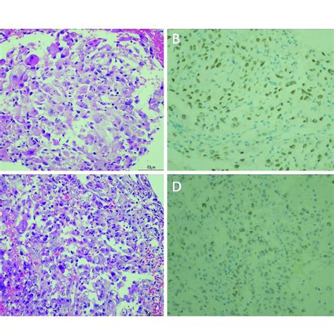 Hematoxylin And Eosin Hande And Immunohistochemical Staining Of The Download Scientific