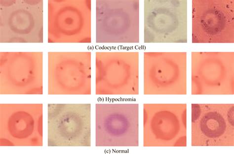 Target Cell