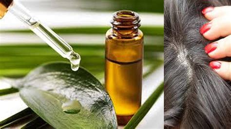 Magical Home Remedy To Remove Dandruff At Homedandruff Treatmenthow