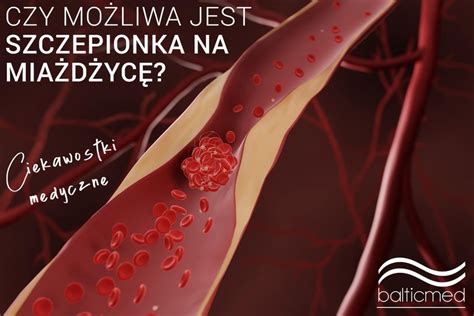 Ciekawostki medyczne czy możliwa jest szczepionka na miażdżycę