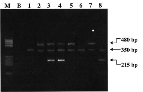 A Representative Multiplex Pcr Analysis Of Gst Polymorphisms Gstm And