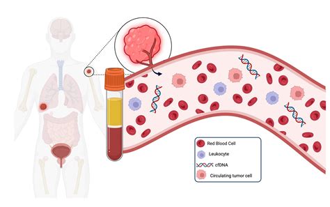 Understanding Circulating Tumor Cell Based Liquid Biopsy — Bloodpac