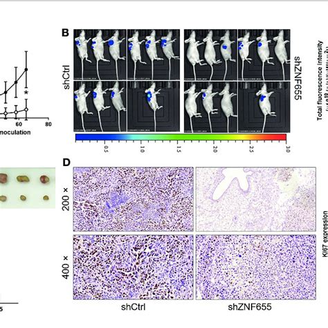 Knockdown Of Znf Inhibits Tumor Growth In Vivo A The Growth Of