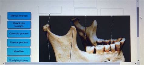 Solved Label The Structures Of The Bone Using The Hints Chegg