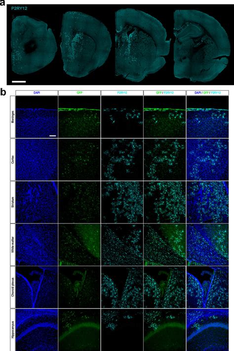 H Microglia Showed A Widespread Distribution Across Multiple Areas Of