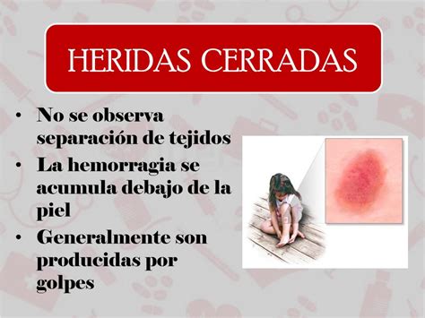 Ppt Heridas Powerpoint Presentation Free Download Id2273969