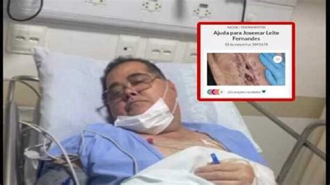 Ap S Complica Es Em Cirurgia Abdominal Cuiabano Cria Vaquinha Virtual