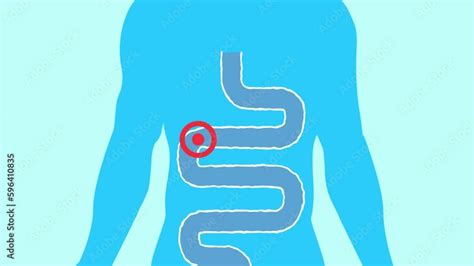 Animation Of Intestinal Microbiome Colonization Of The Colon And