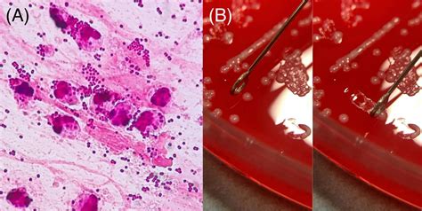 Moraxella Catarrhalis Gram Stain