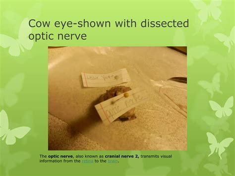 Cow eye – dissection and label | PPTX