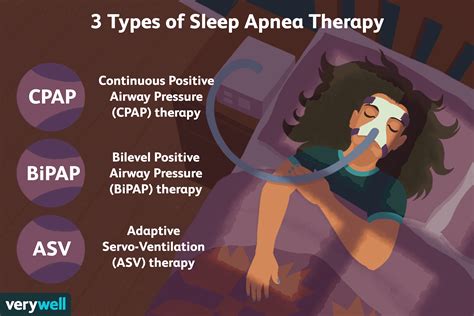 Diferencias entre la terapia CPAP BiPAP y ASV para la apnea del sueño