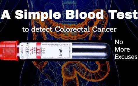 Simple Blood Test For Colorectal Cancer Screening By Ascendant Health