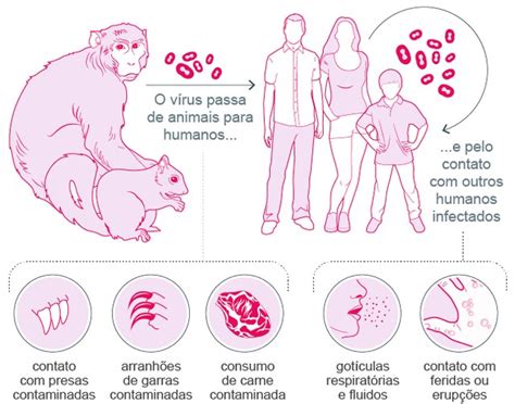 Varíola dos macacos dos sintomas ao tratamento tudo que você precisa