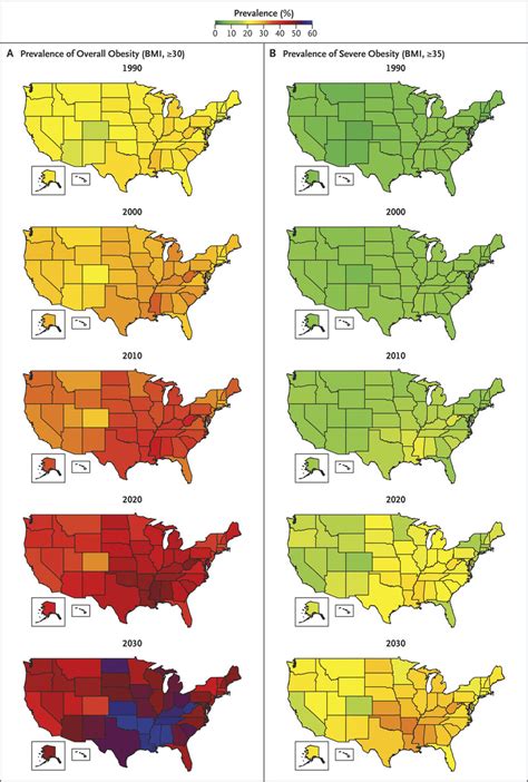 Projected U S State Level Prevalence Of Adult Obesity And Severe