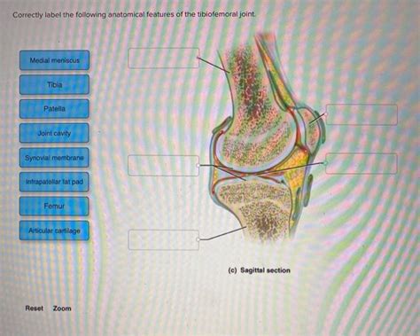 Solved Correctly Label The Following Anatomical Features Of