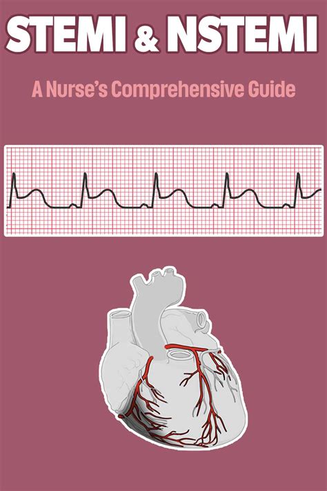 Stemi Nstemi A Nurse S Comprehensive Guide Health And Willness