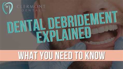 DENTAL DEBRIDEMENT EXPLAINED What You Need To Know Debridement