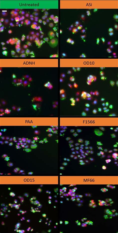 Mcf 7 Cell Line Exposed To Basic Mnp Formulations Representative Download Scientific Diagram