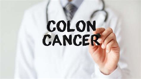 Colon Cancer Diagnosis Treatment Diet And Prevention