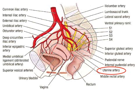 Uterine Artery Stepwards