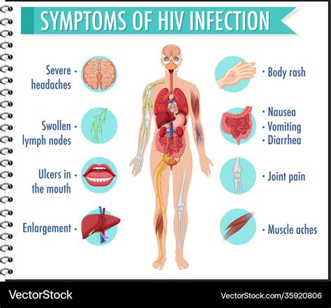 Symptoms Hiv Infection Infographic Royalty Free Vector Image