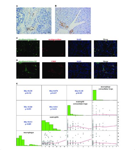 Staining Patterns And The Correlation Of Tumor Infiltrating