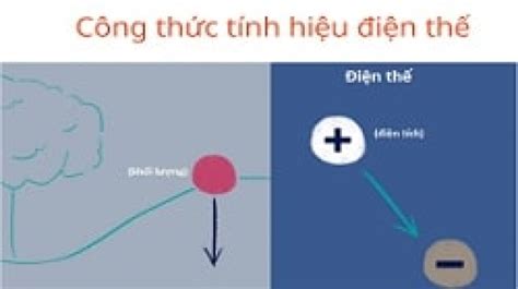 Hiệu Điện Thế Giữa Anot và Catot Tìm Hiểu Chi Tiết và Ứng Dụng