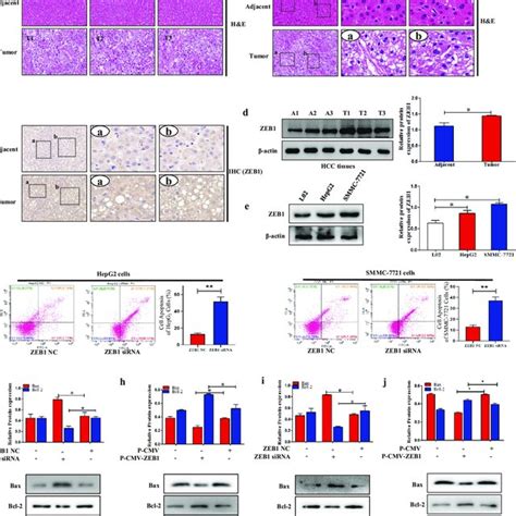 Zeb Promoted The Process Of Emt In Hcc A Ihc Of E Cadherin