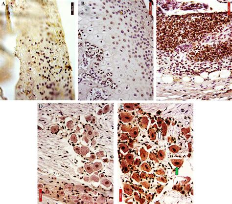 Immunostaining for IL 1β in the temporomandibular joint and trigeminal