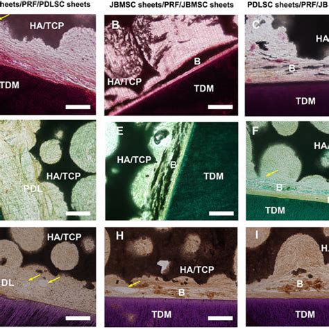 Mimicking Periodontal Regeneration In A Nude Mouse Model Using A PRF