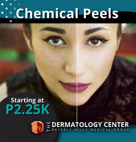 Chemical Peel Beverly Hills Medical Group