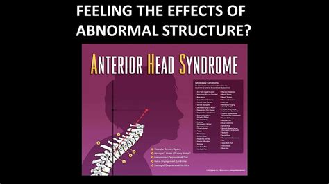 NECK PAIN FAQ: LIGAMENTS - THE OFTEN OVERLOOKED CAUSE