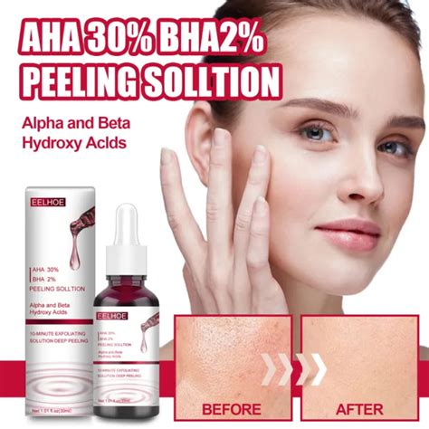 Face Peeling Solution Aha 30 Bha 2 Fruit Acid Salicylic Acid Acne