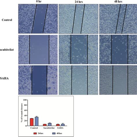 Effect Of Sacubitrilat And Saha On The Morphology Of Sw And