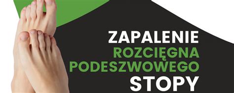 Zapalenie rozcięgna podeszwowego stopy Rehabilitacja Wrocław