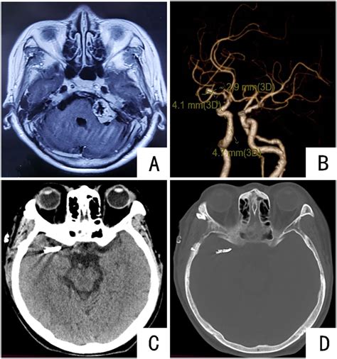 Preoperative And Postoperative Imaging Examinations Of The Patient A