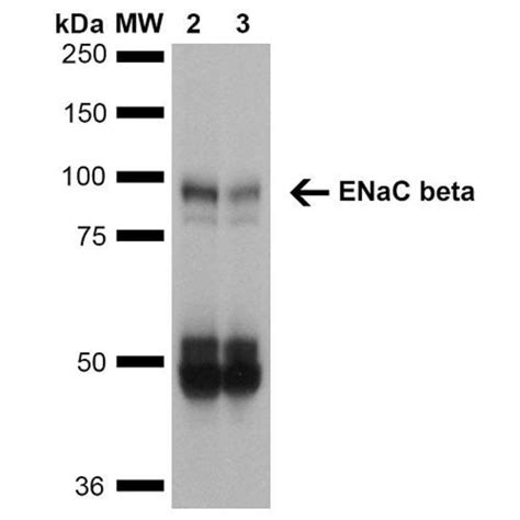 ENaC beta Monoclonal Antibody 16E4 QED Bioscience 100 μg