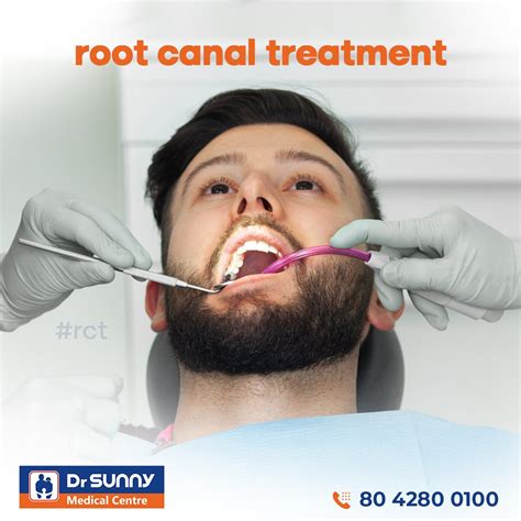 Root Canal Treatment Everything You Need To Know Dr Sunny Medical Centre Bellandur