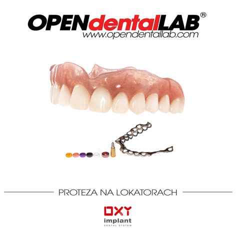 Proteza Na Lokatorach Na Implantach Ze Wzmocnieniem Open Dental Lab