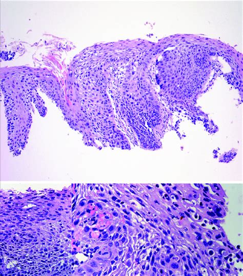 Histology Images Haematoxylin Eosin 40x Upper Image 400x Lower